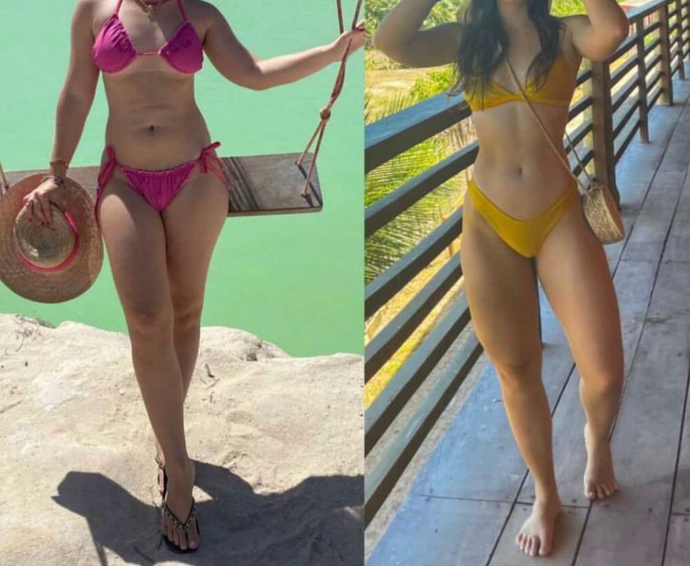 Transformação de paciente — antes e depois