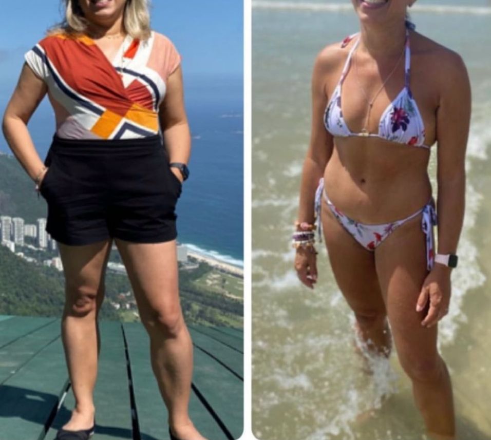 Transformação de paciente — antes e depois